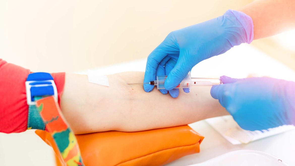 How To Stay Calm During a Blood Test?