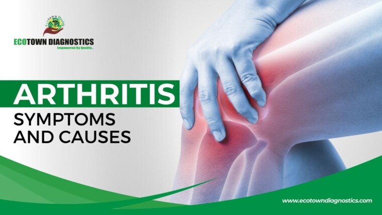Arthritis Symptoms and Causes: Understanding Joint Pain