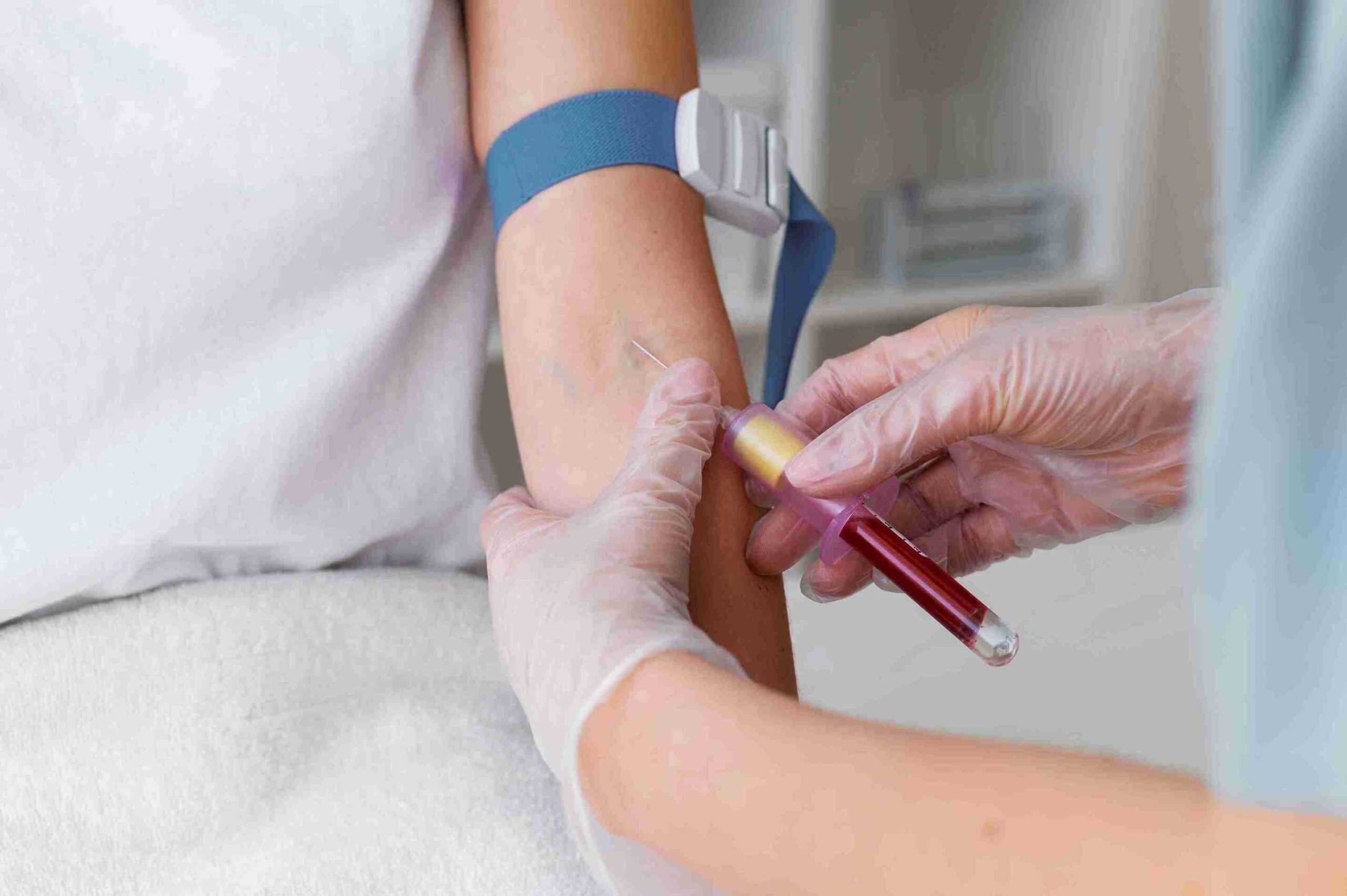 opting for home blood test in Bangalore services